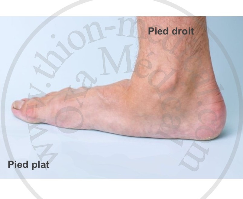 Photo de pied plat